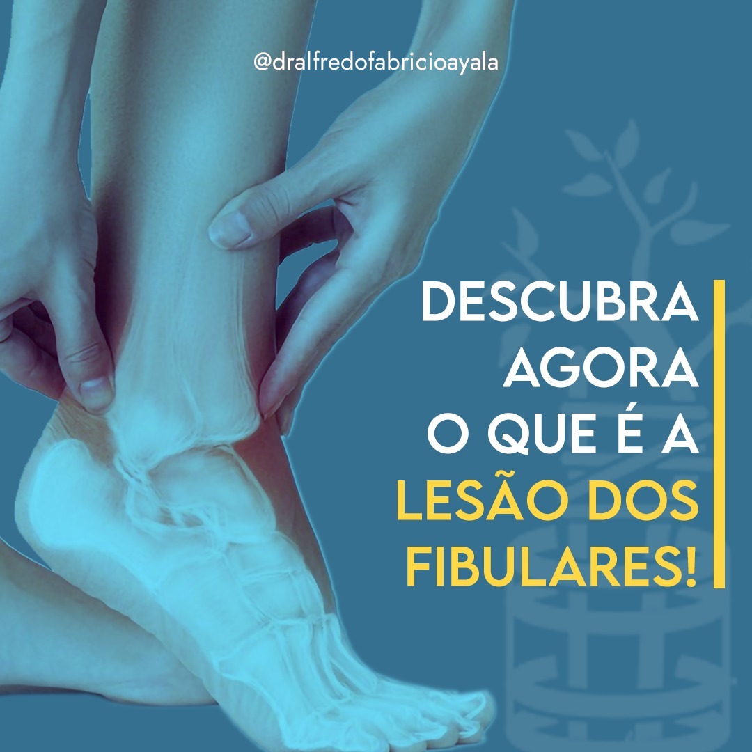 Descubra Agora O Que A Les o Fibulares Centro M dico Domingos descubra-agora-o-que-a-les-o-fibulares-centro-m-dico-domingos